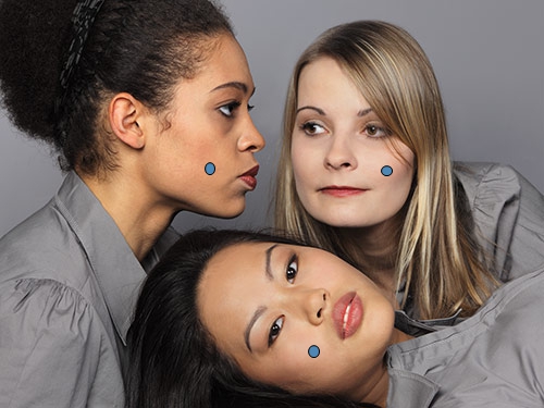 The picture areas marked with circles